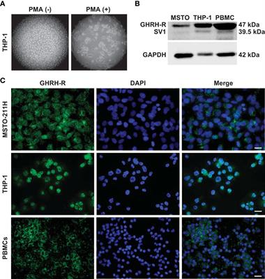 Growth hormone-releasing hormone antagonist MIA-602 inhibits inflammation induced by SARS-CoV-2 spike protein and bacterial lipopolysaccharide synergism in macrophages and human peripheral blood mononuclear cells